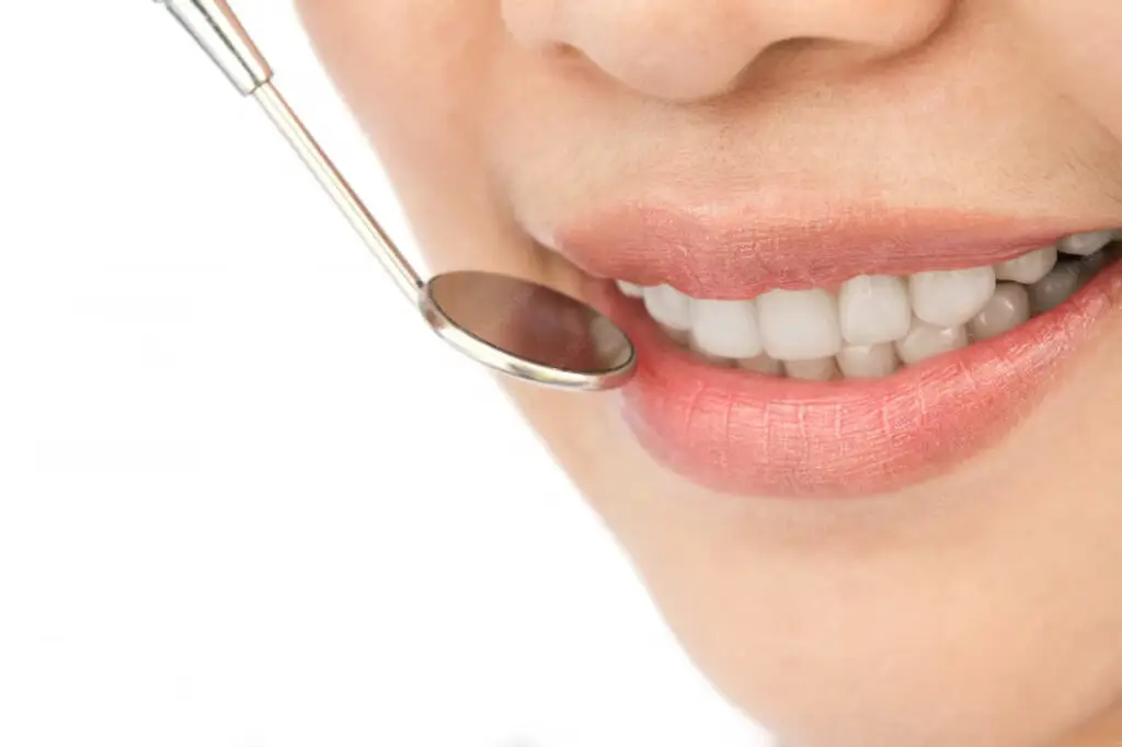 White Gingiva